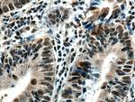 SMC1A Antibody in Immunohistochemistry (Paraffin) (IHC (P))