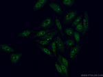 NFKB1 p105/p50 Antibody in Immunocytochemistry (ICC/IF)