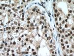 NFKB1 p105/p50 Antibody in Immunohistochemistry (Paraffin) (IHC (P))