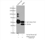 RRM2 Antibody in Immunoprecipitation (IP)