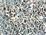 PLCG2 Antibody in Immunohistochemistry (Paraffin) (IHC (P))