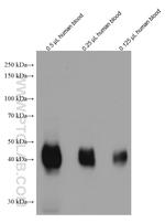 ICAM4 Antibody in Western Blot (WB)