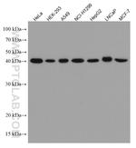 STBD1 Antibody in Western Blot (WB)