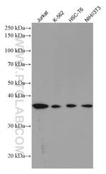 RAD51 Antibody in Western Blot (WB)