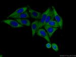 RPL4 Antibody in Immunocytochemistry (ICC/IF)