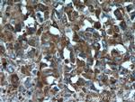 RPL4 Antibody in Immunohistochemistry (Paraffin) (IHC (P))