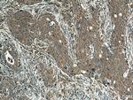 FLII Antibody in Immunohistochemistry (Paraffin) (IHC (P))