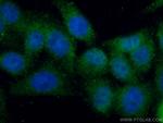 MLX Antibody in Immunocytochemistry (ICC/IF)