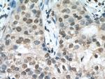 MLX Antibody in Immunohistochemistry (Paraffin) (IHC (P))