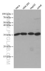 MLX Antibody in Western Blot (WB)