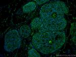 PELP1 Antibody in Immunohistochemistry (Paraffin) (IHC (P))