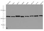 INTS3 Antibody in Western Blot (WB)