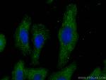 C1QA Antibody in Immunocytochemistry (ICC/IF)