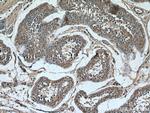 PLCD1 Antibody in Immunohistochemistry (Paraffin) (IHC (P))
