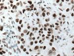 Cyclin H Antibody in Immunohistochemistry (Paraffin) (IHC (P))