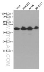ATF5 Antibody in Western Blot (WB)