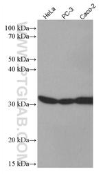 ESD Antibody in Western Blot (WB)