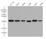 ESD Antibody in Western Blot (WB)