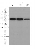 ESD Antibody in Western Blot (WB)
