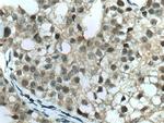 TFAP2A/AP-2 Antibody in Immunohistochemistry (Paraffin) (IHC (P))