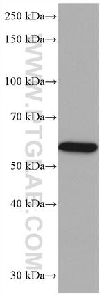 CES1 Antibody in Western Blot (WB)