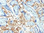 Spectrin Alpha 1 Monoclonal Antibody (SPTA1, 1810)