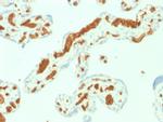 Spectrin Alpha 1 Monoclonal Antibody (SPTA1, 1832)