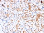 Spectrin Alpha 1 (Erythrocyte Marker) Monoclonal Antibody (rSPTA1/1832)