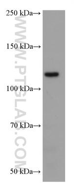 EPHB1 Antibody in Western Blot (WB)