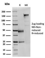 Fodrin/Alpha Spectrin II (SPTAN1)/NEAS Antibody in SDS-PAGE (SDS-PAGE)