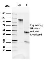 Fodrin/Alpha Spectrin II (SPTAN1)/NEAS Antibody in SDS-PAGE (SDS-PAGE)