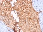 Fodrin/Alpha Spectrin II (SPTAN1)/NEAS Antibody in Immunohistochemistry (Paraffin) (IHC (P))