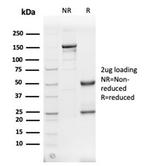 Fodrin/Alpha Spectrin II (SPTAN1)/NEAS Antibody in Immunoelectrophoresis (IE)