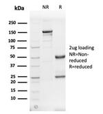 Fodrin/Alpha Spectrin II (SPTAN1)/NEAS Antibody in SDS-PAGE (SDS-PAGE)