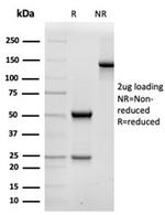 Fodrin/Alpha Spectrin II (SPTAN1)/NEAS Antibody in Immunoelectrophoresis (IE)