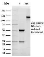 Fodrin/Alpha Spectrin II (SPTAN1)/NEAS Antibody in SDS-PAGE (SDS-PAGE)