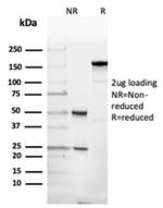 Fodrin/Alpha Spectrin II (SPTAN1)/NEAS Antibody in SDS-PAGE (SDS-PAGE)