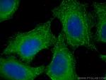 ASAH1 Antibody in Immunocytochemistry (ICC/IF)
