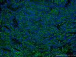 RALB Antibody in Immunohistochemistry (Paraffin) (IHC (P))