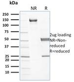 Spectrin beta I (SPTB) Monoclonal Antibody (RG/26)