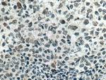 MAD2L2 Antibody in Immunohistochemistry (Paraffin) (IHC (P))
