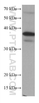 DUSP12 Antibody in Western Blot (WB)