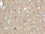 DLG3 Antibody in Immunohistochemistry (Paraffin) (IHC (P))