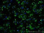 L1CAM Antibody in Immunohistochemistry (Paraffin) (IHC (P))