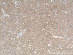 L1CAM Antibody in Immunohistochemistry (Paraffin) (IHC (P))
