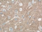 L1CAM Antibody in Immunohistochemistry (Paraffin) (IHC (P))