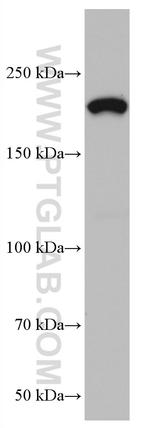 L1CAM Antibody in Western Blot (WB)