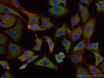 RAB3D Antibody in Immunocytochemistry (ICC/IF)