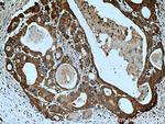 RAB3D Antibody in Immunohistochemistry (Paraffin) (IHC (P))