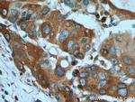 RAB3D Antibody in Immunohistochemistry (Paraffin) (IHC (P))